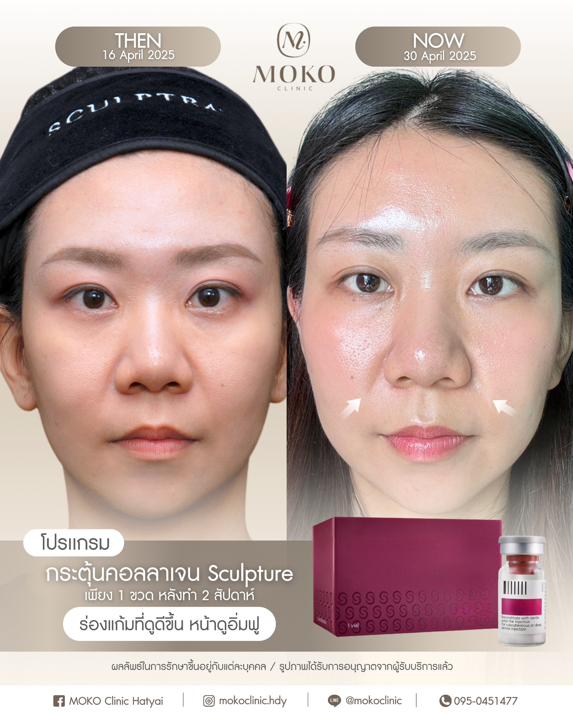 Before After Results 3